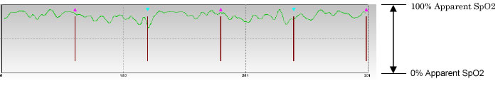 Apparent SpO2計算結果のグラフ表示